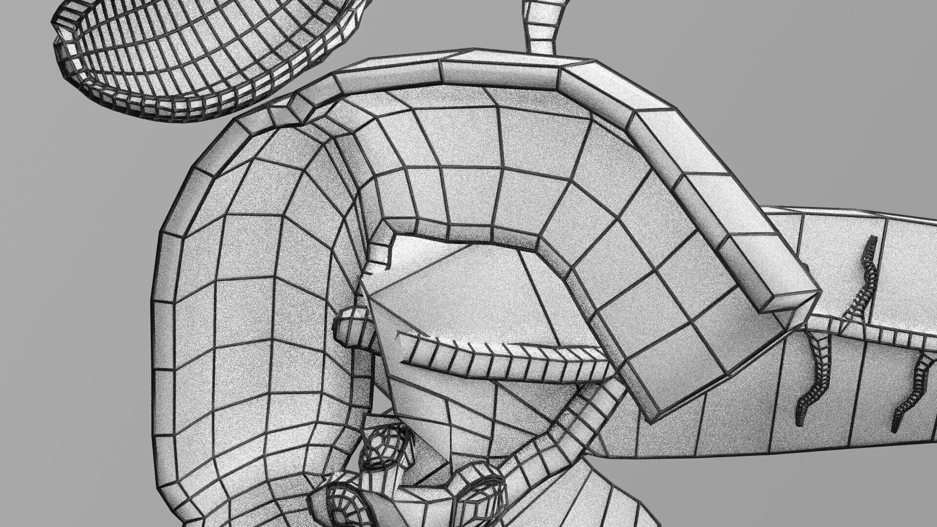 Biliary tract stone obstructions gallstone Low-poly 3D model_69