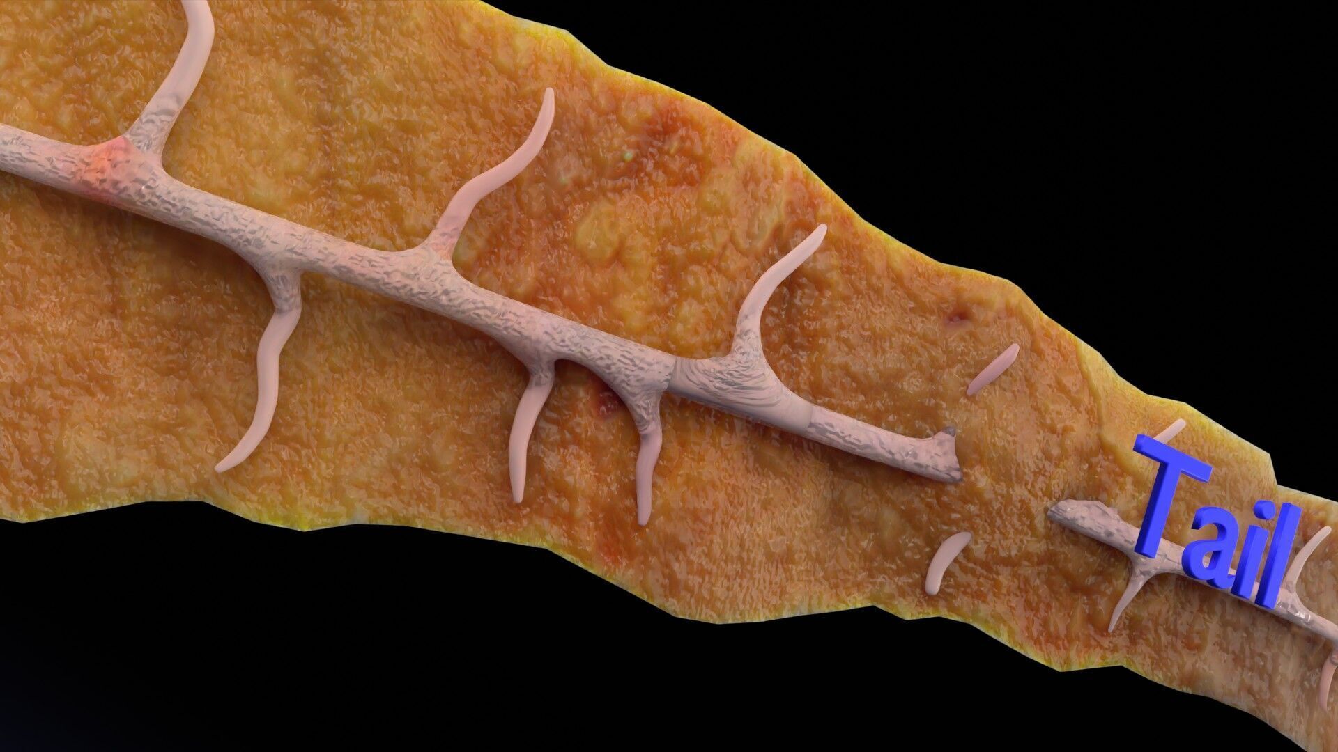 Biliary tract stone obstructions gallstone Low-poly 3D model_27