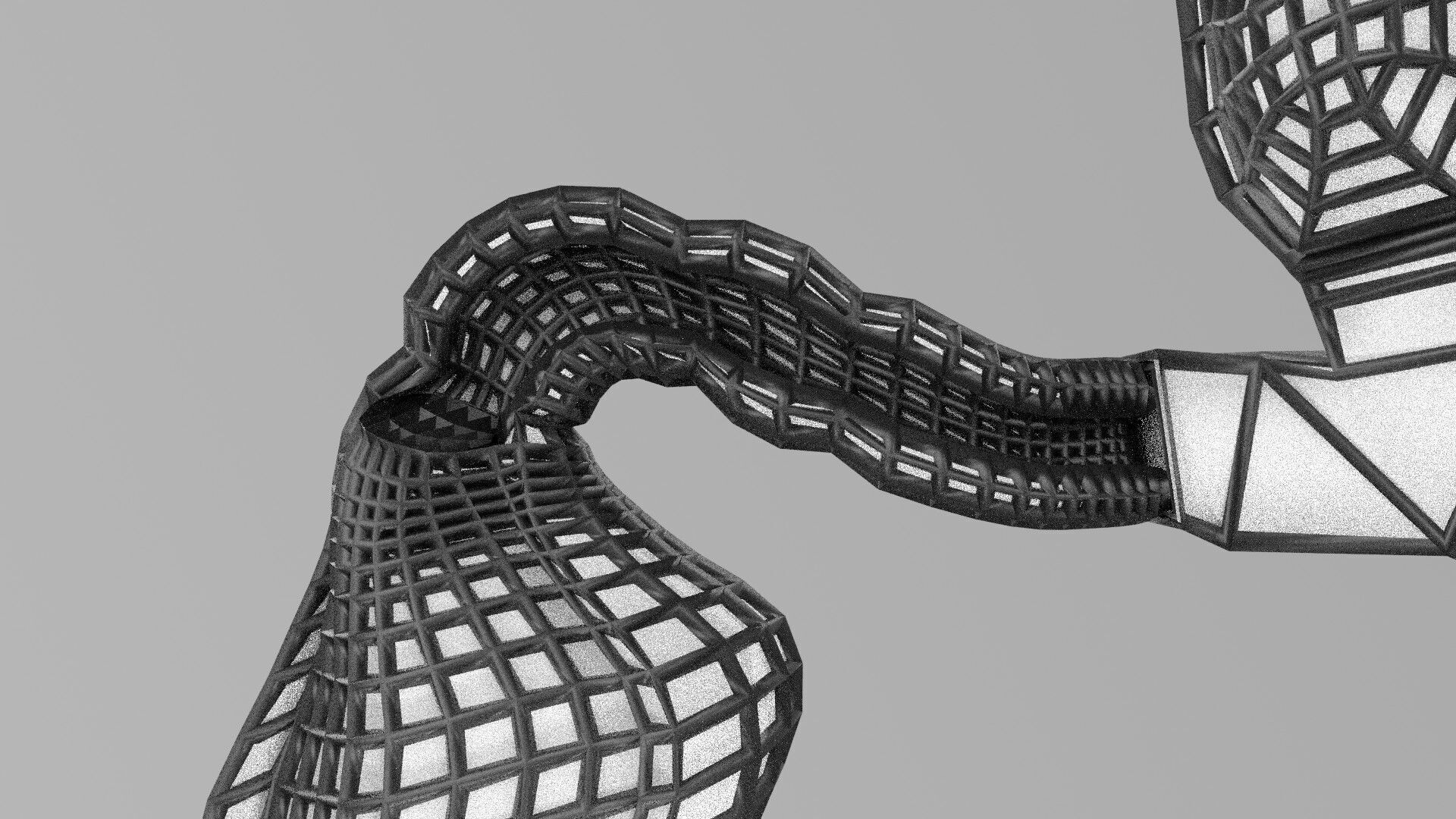 Biliary tract stone obstructions gallstone Low-poly 3D model_52