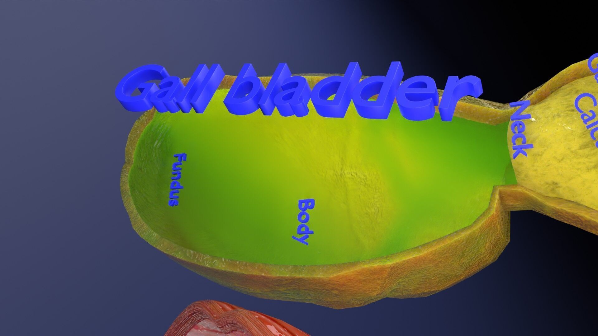 Biliary tract stone obstructions gallstone Low-poly 3D model_8