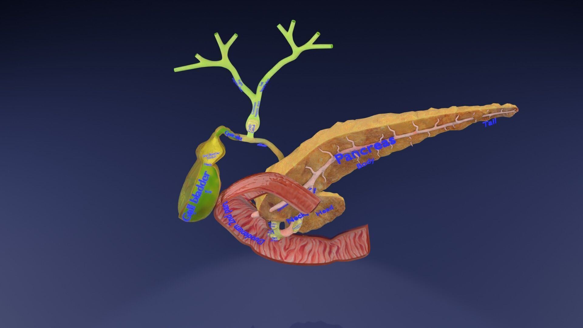 Biliary tract stone obstructions gallstone Low-poly 3D model_2