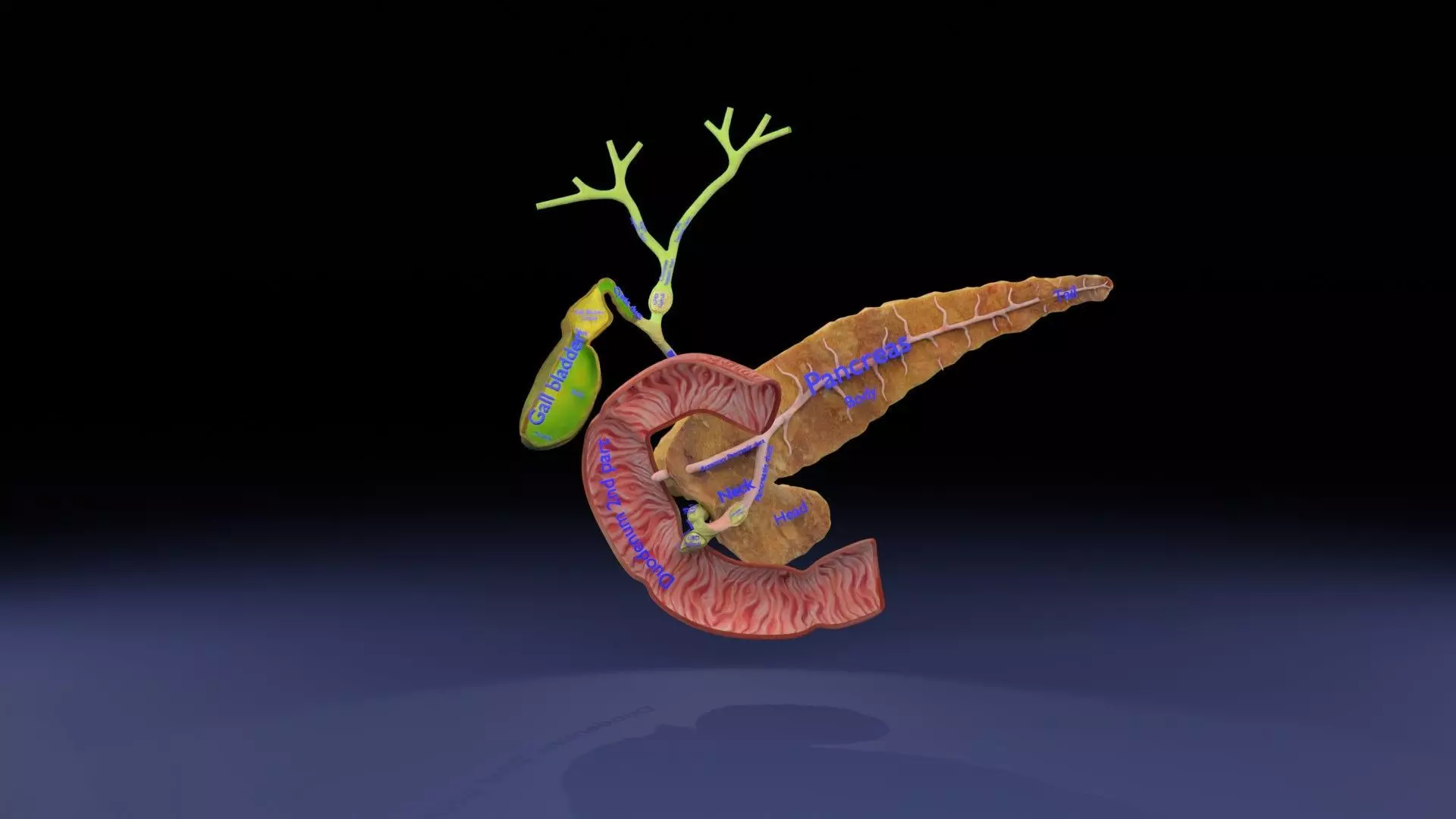 Biliary tract stone obstructions gallstone Low-poly 3D model_0