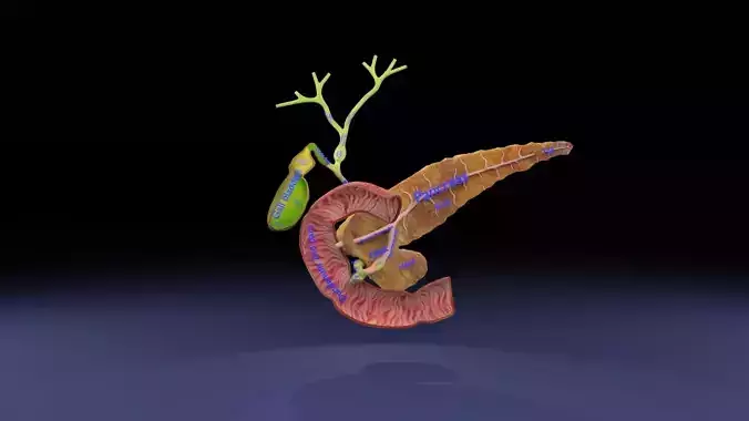Biliary tract stone obstructions gallstone Low-poly 3D model