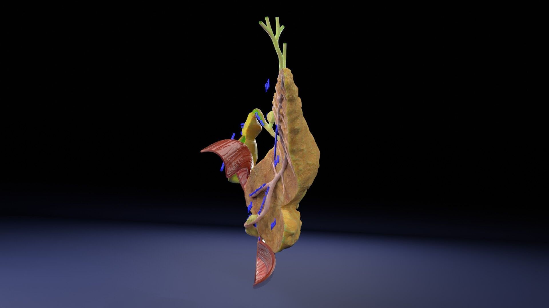 Biliary tract stone obstructions gallstone Low-poly 3D model_34