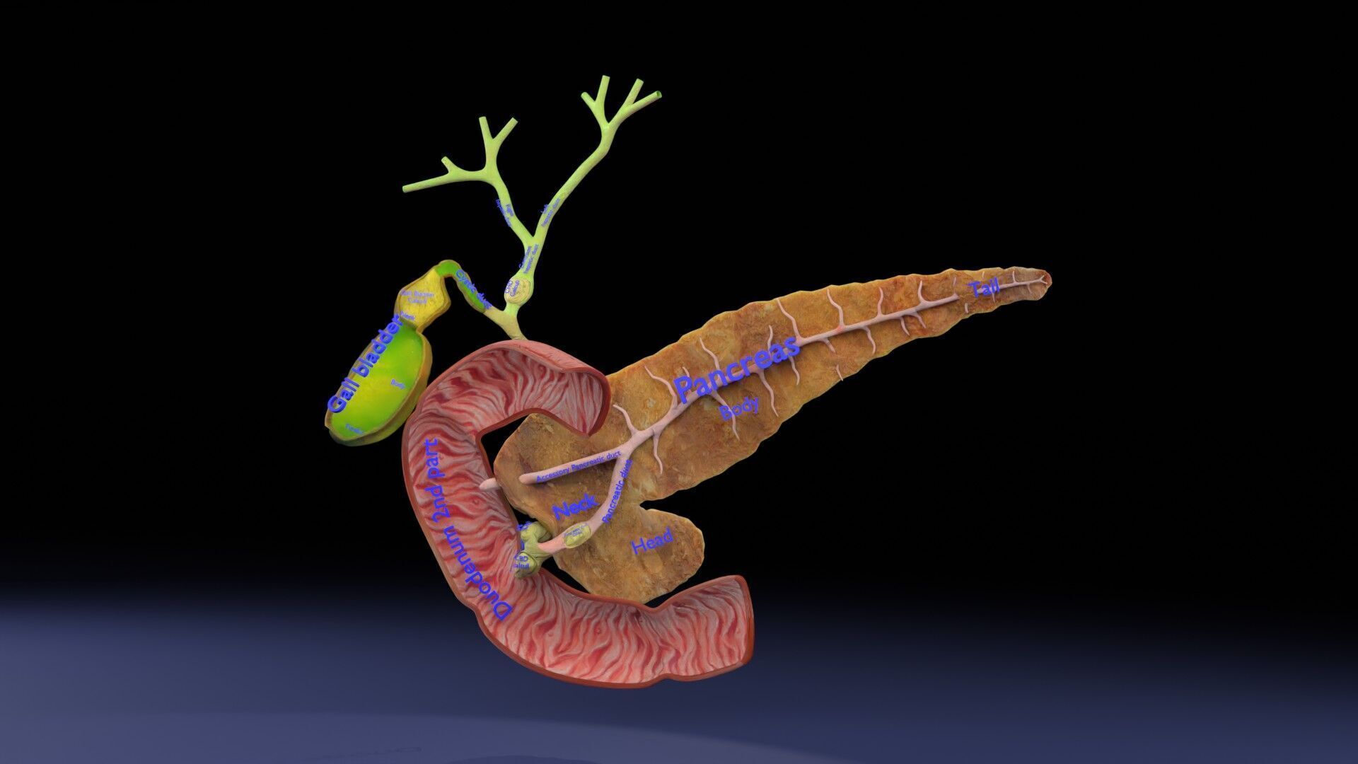 Biliary tract stone obstructions gallstone Low-poly 3D model_33