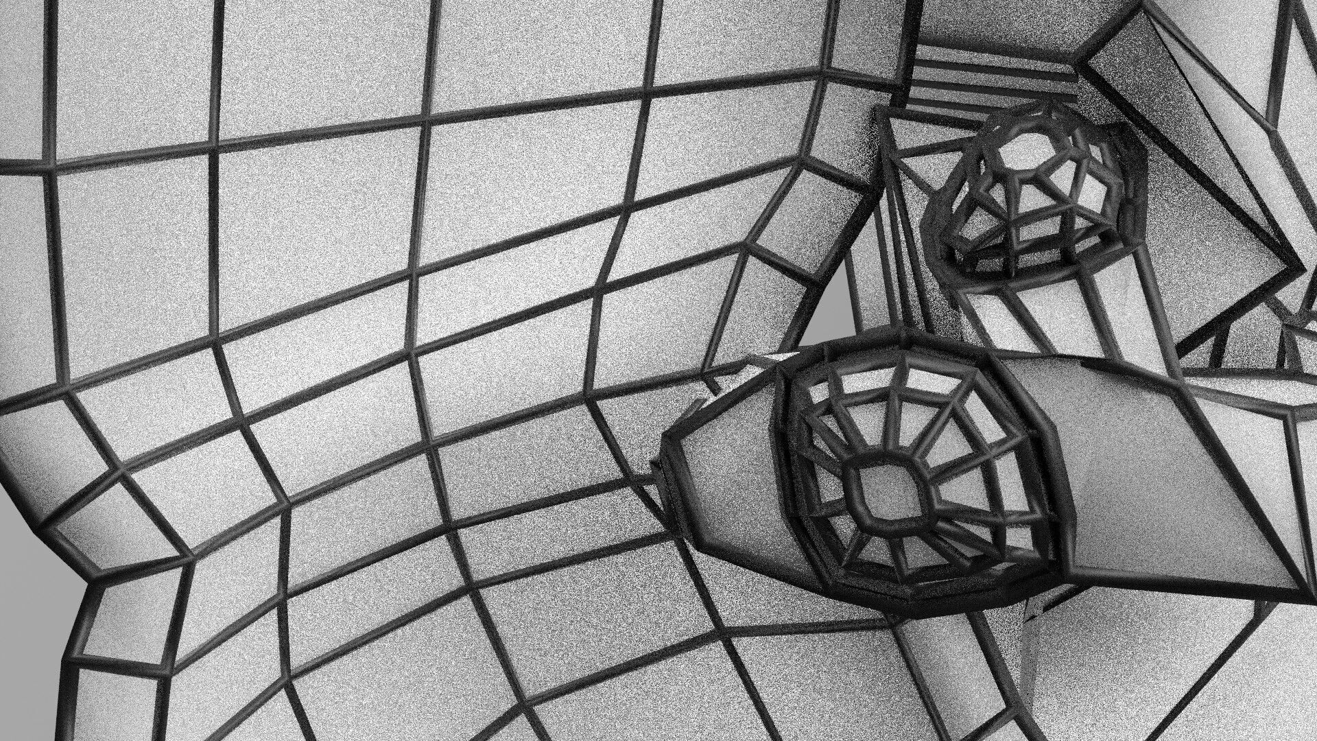 Biliary tract stone obstructions gallstone Low-poly 3D model_70