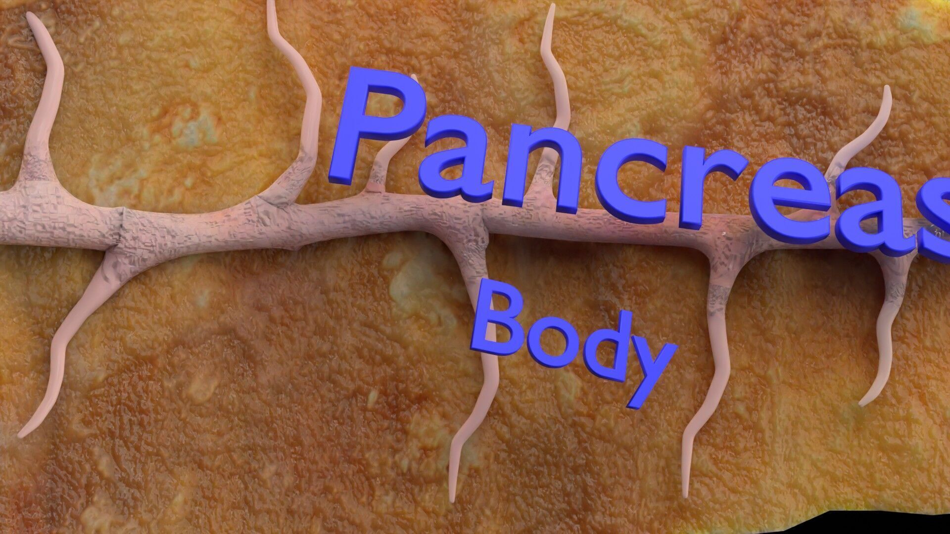 Biliary tract stone obstructions gallstone Low-poly 3D model_26