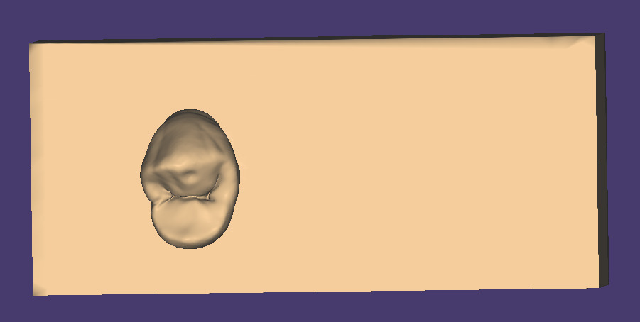 Dental Carving model for Upper first premolar 3D model_3