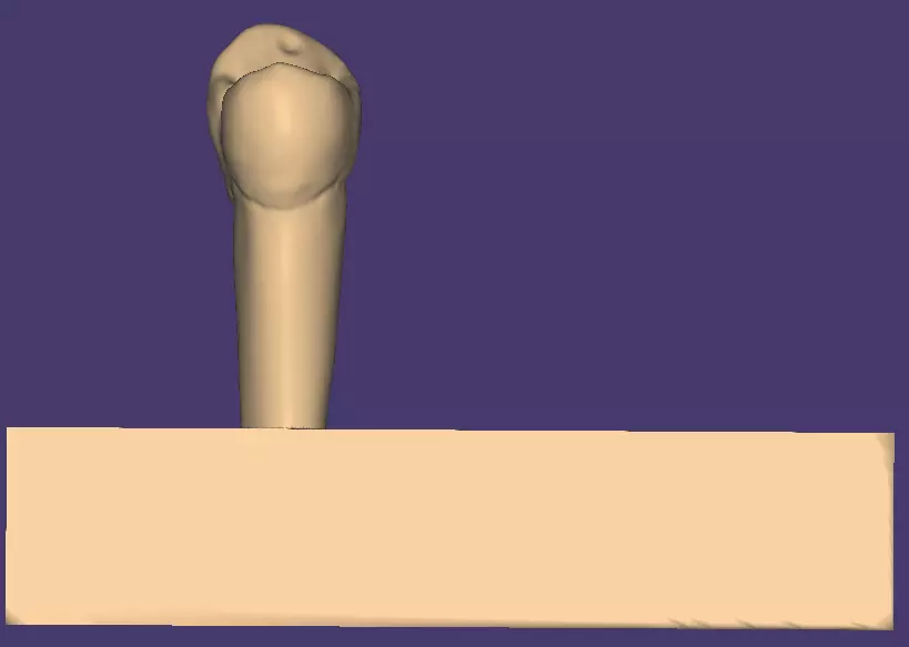 Dental Carving model for Upper first premolar 3D model_0