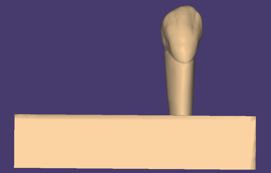 Dental Carving model for Upper first premolar 3D model_2