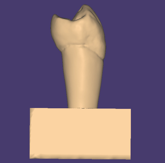 Dental Carving model for Upper first premolar 3D model_1