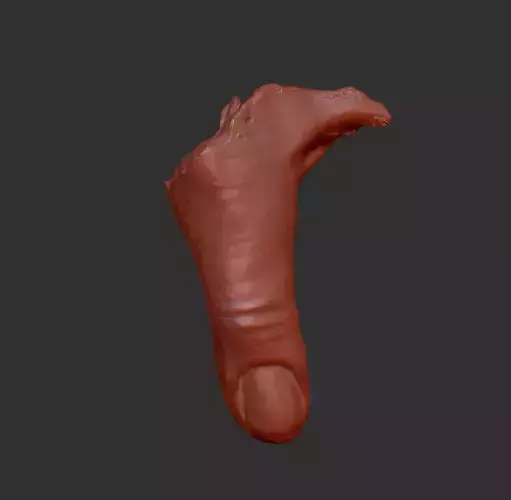 Severed Thumb