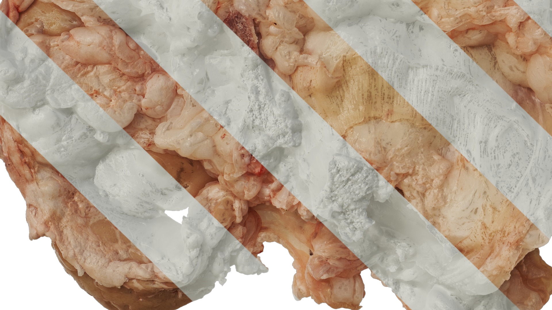 Anydrafts Lymph meat 02 Texture_5