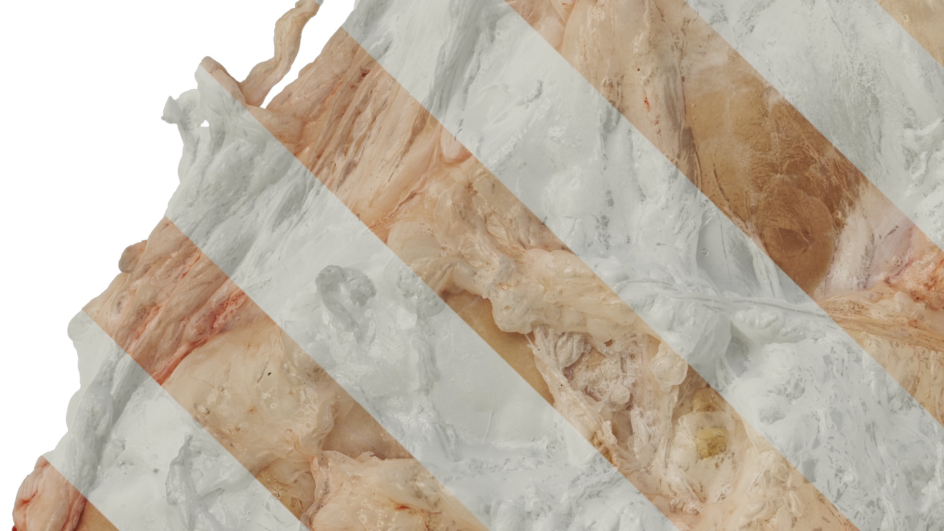 Anydrafts Lymph meat 02 Texture_3