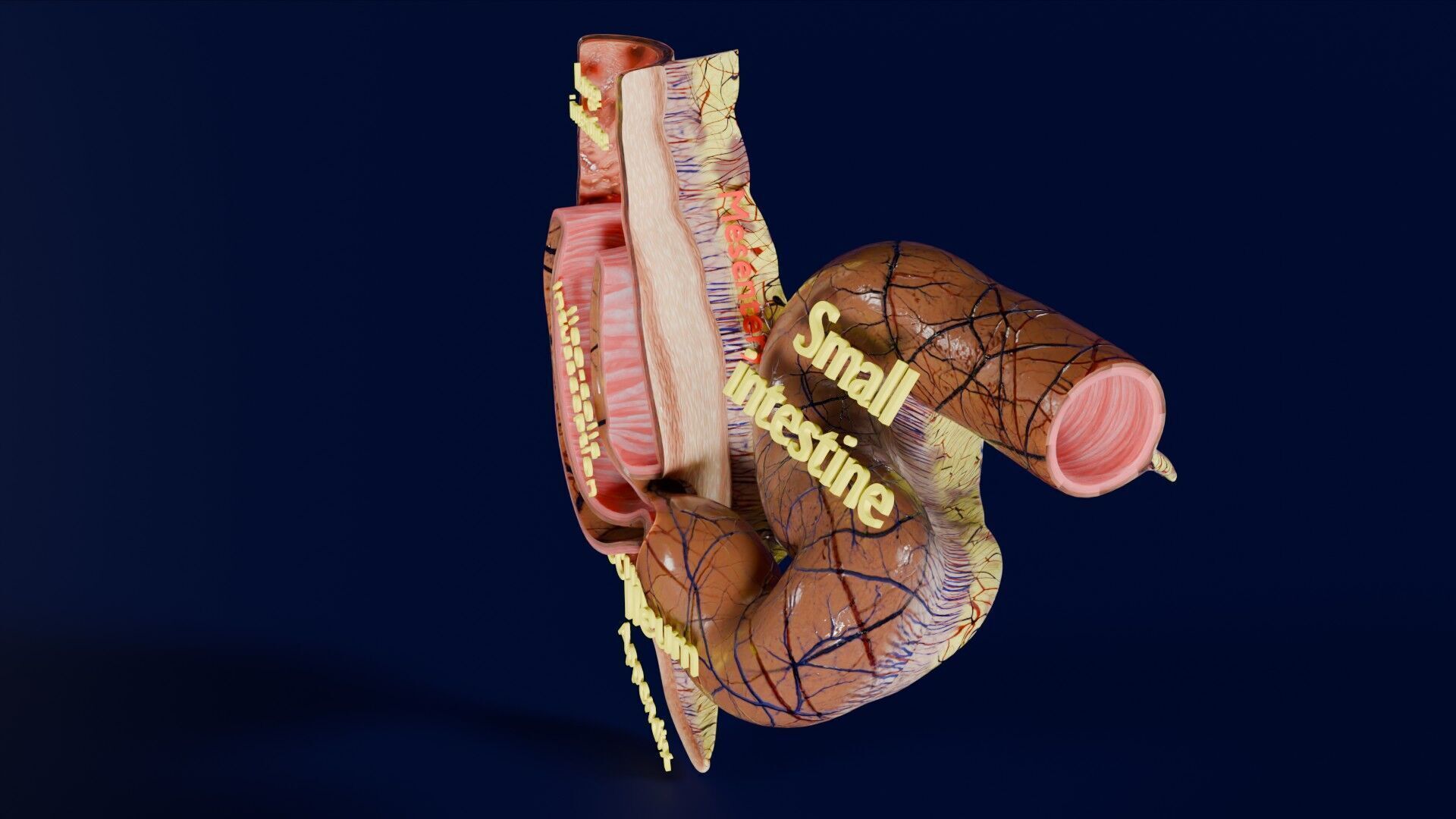 Intussusception intestine ileocolic obstruction Low-poly 3D model_41