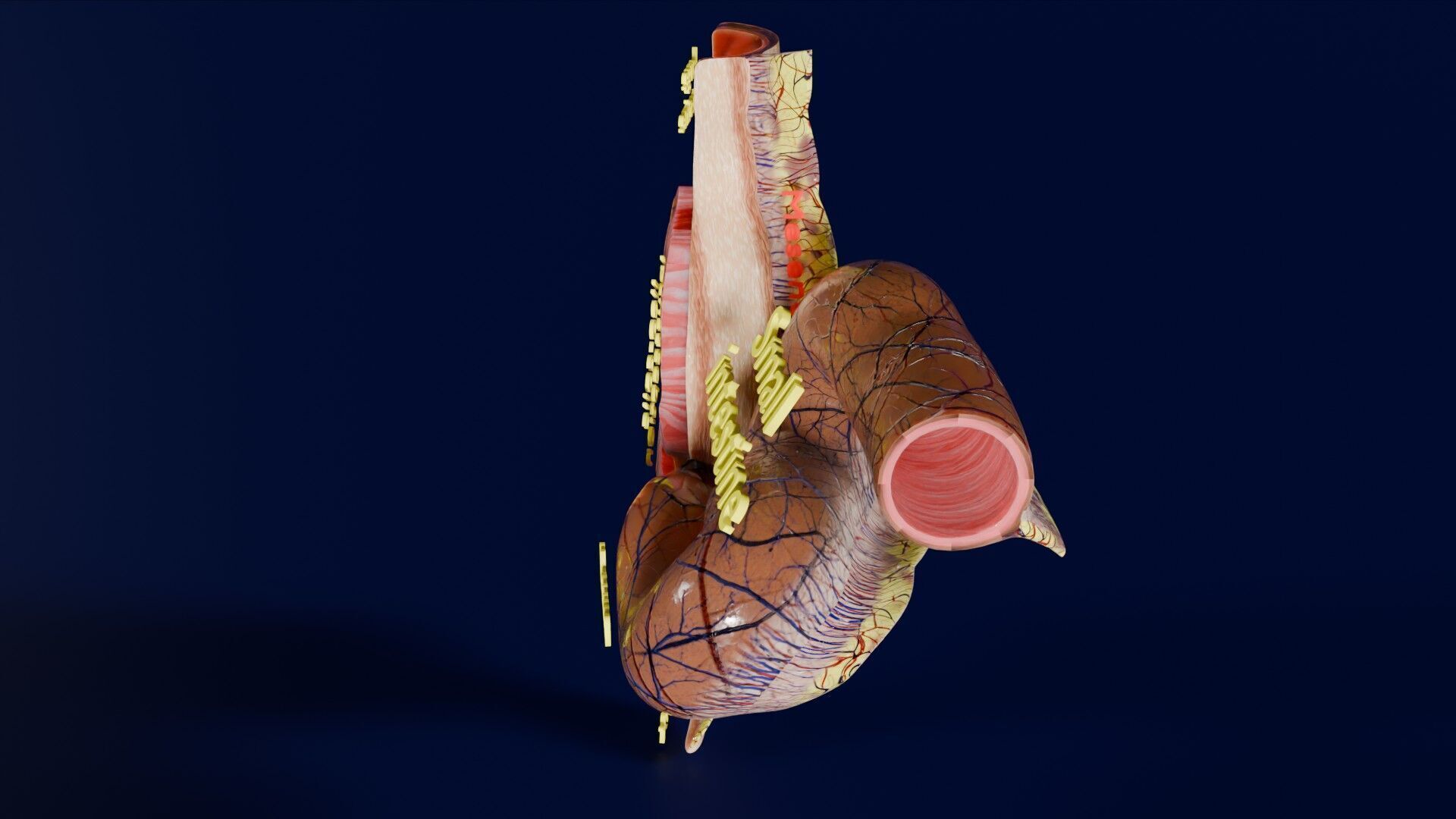 Intussusception intestine ileocolic obstruction Low-poly 3D model_39