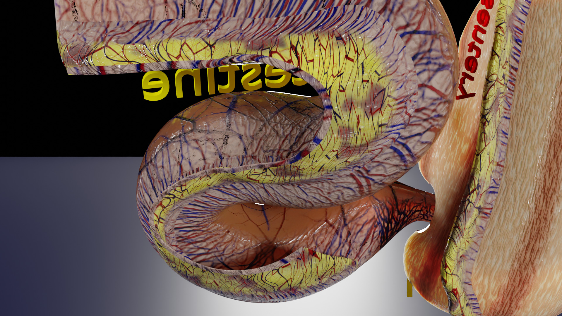 Intussusception intestine ileocolic obstruction Low-poly 3D model_8