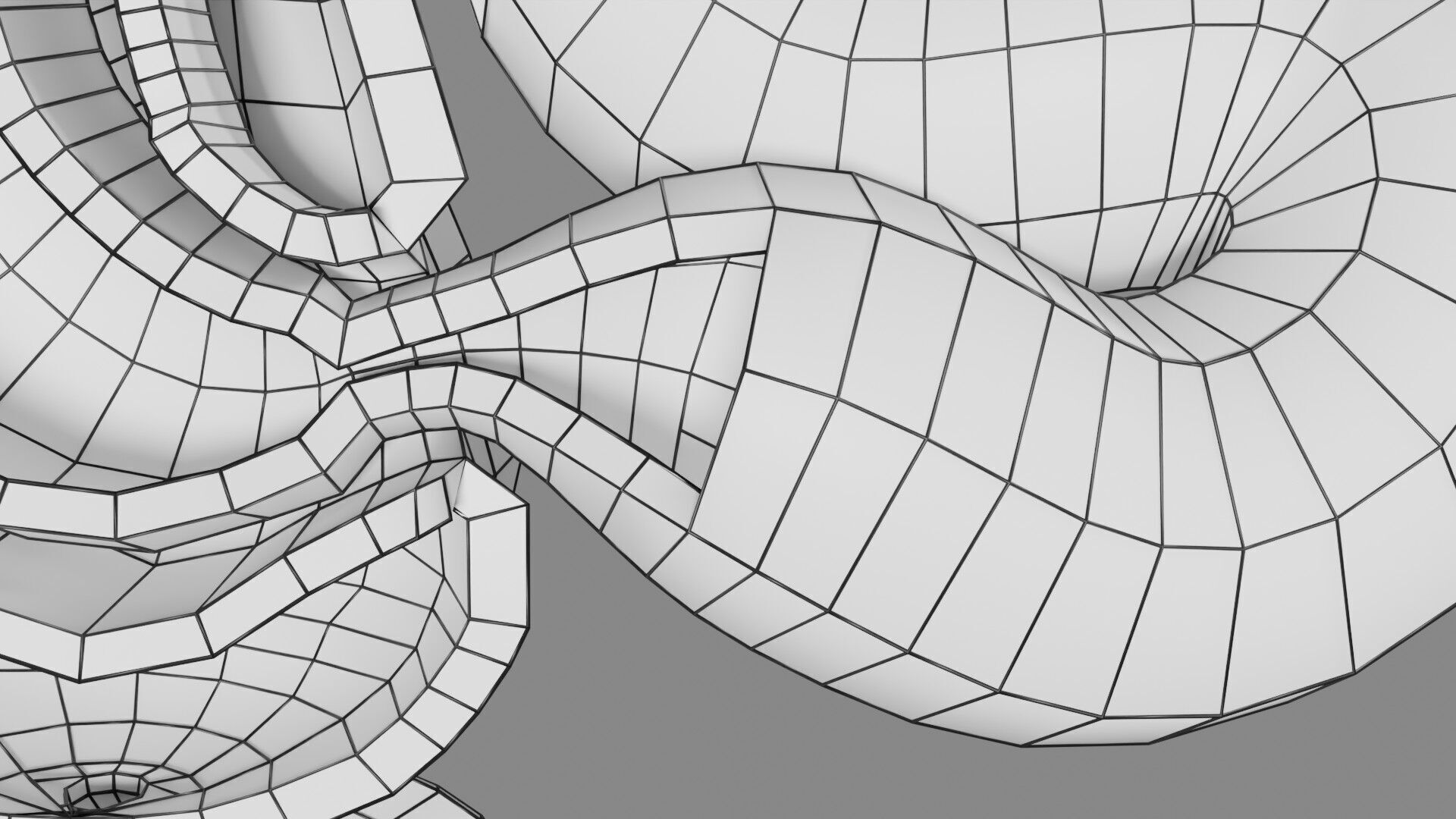 Intussusception intestine ileocolic obstruction Low-poly 3D model_61