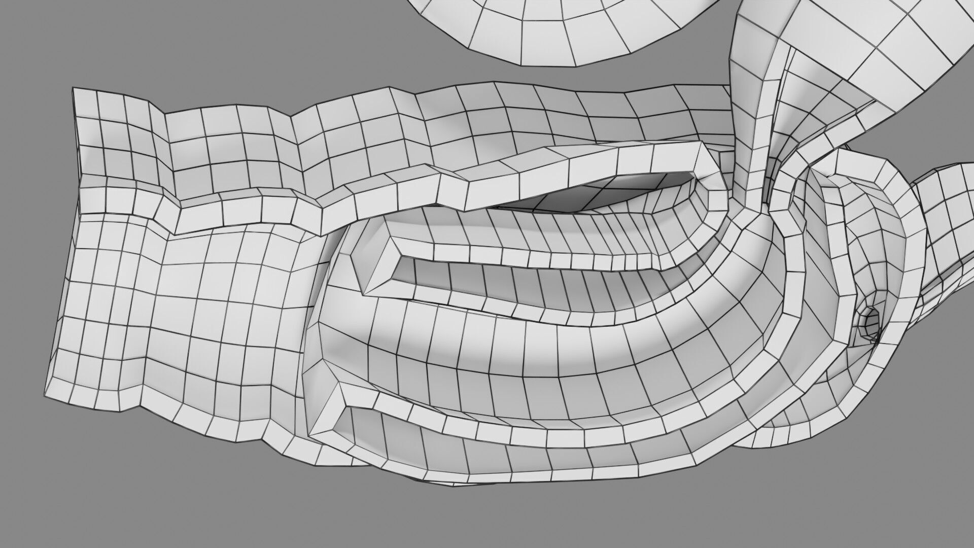 Intussusception intestine ileocolic obstruction Low-poly 3D model_64