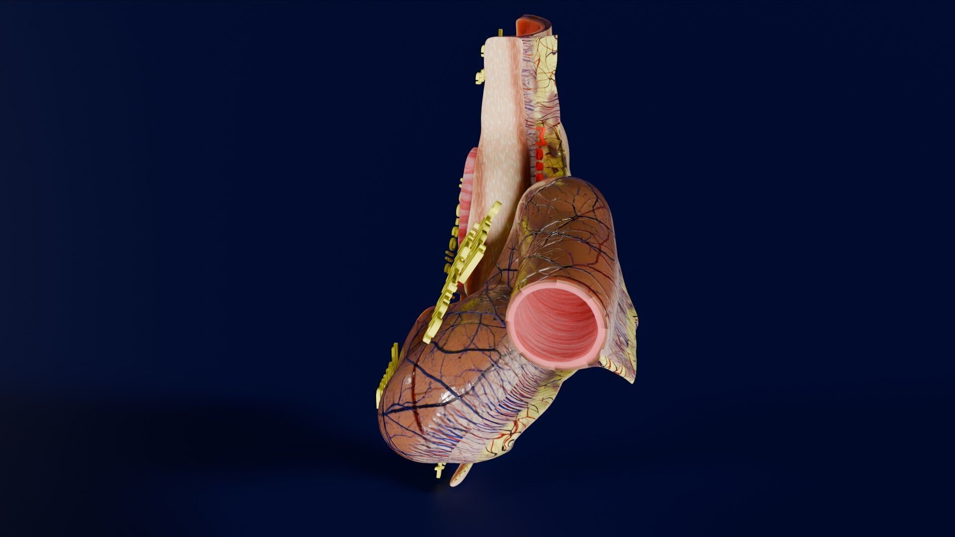 Intussusception intestine ileocolic obstruction Low-poly 3D model_38