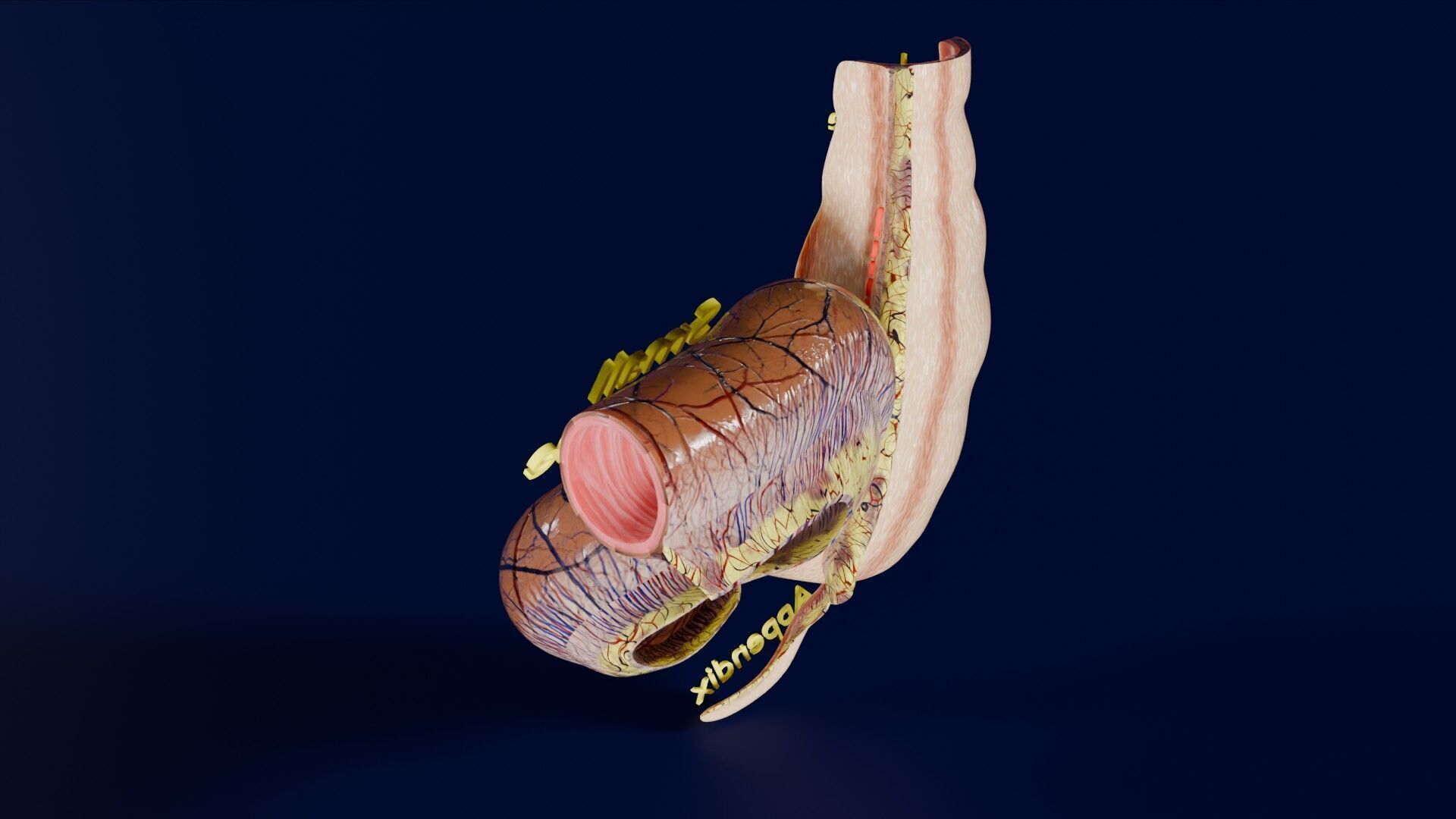 Intussusception intestine ileocolic obstruction Low-poly 3D model_36