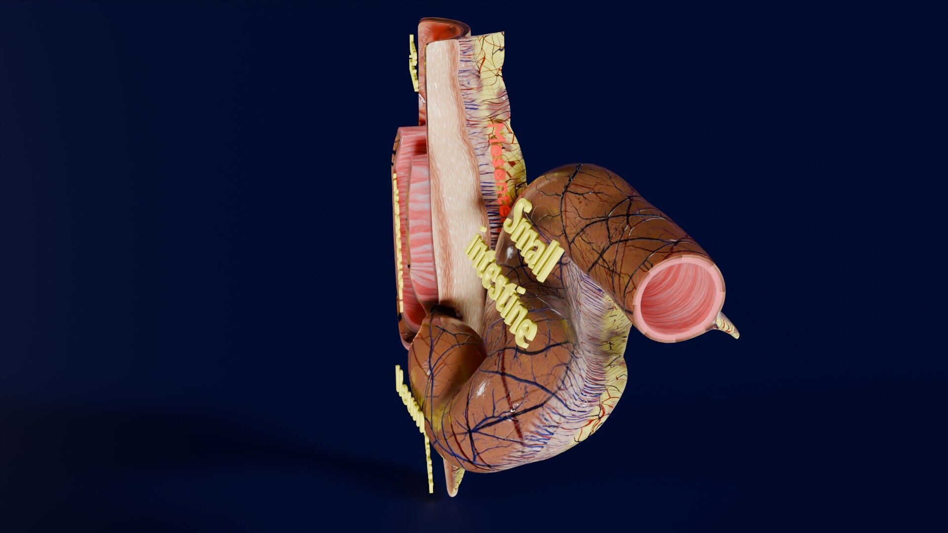 Intussusception intestine ileocolic obstruction Low-poly 3D model_40