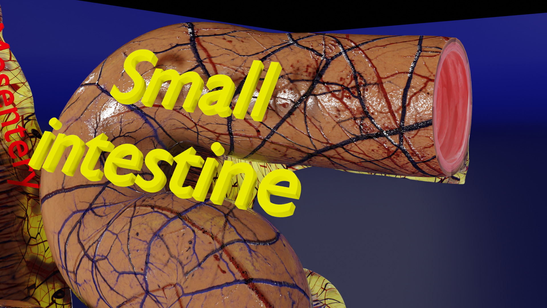 Intussusception intestine ileocolic obstruction Low-poly 3D model_6