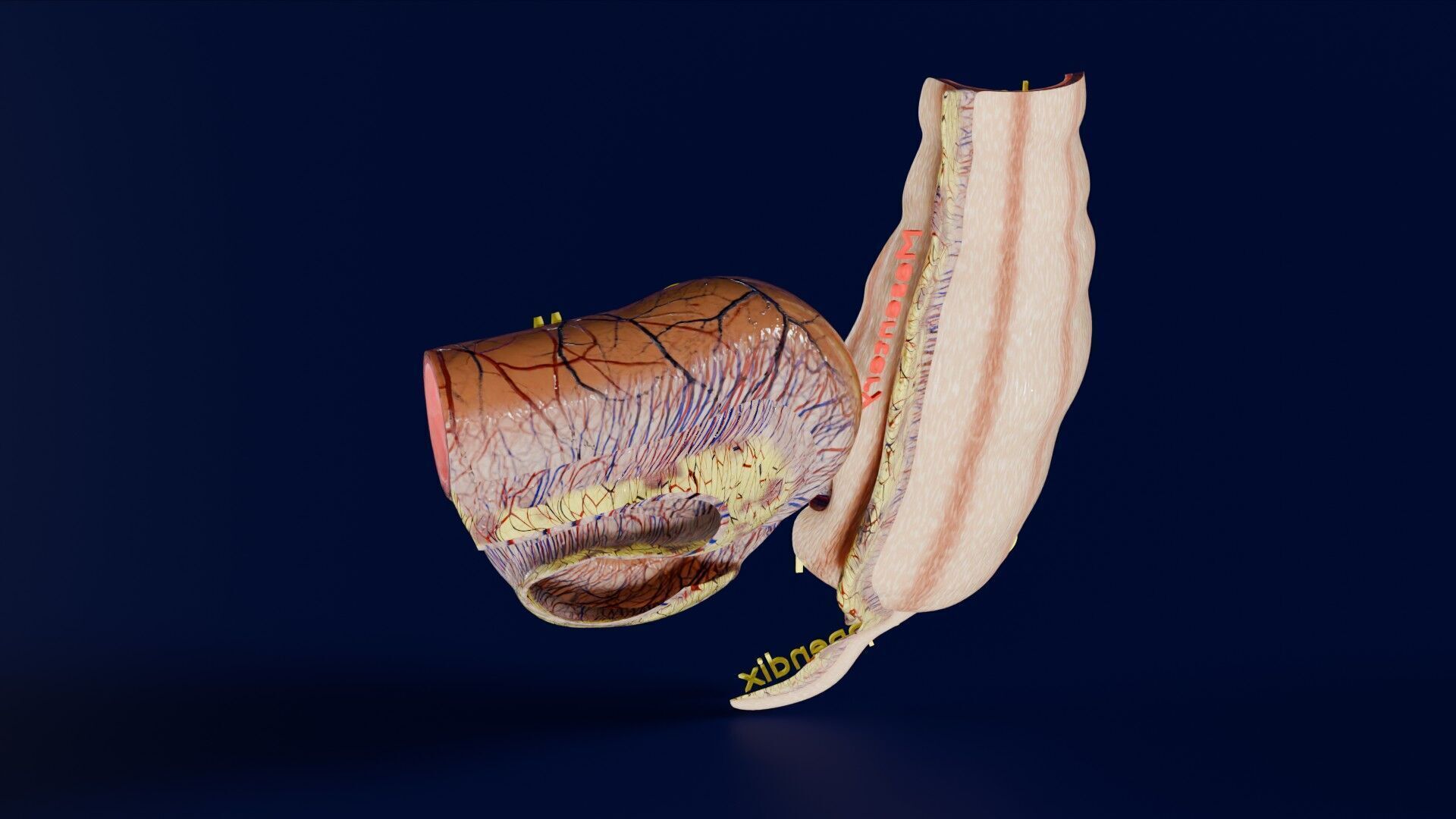 Intussusception intestine ileocolic obstruction Low-poly 3D model_34