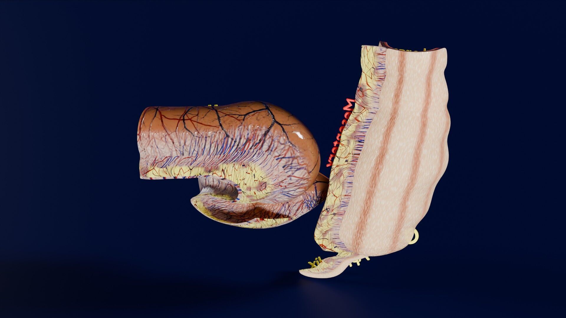 Intussusception intestine ileocolic obstruction Low-poly 3D model_32