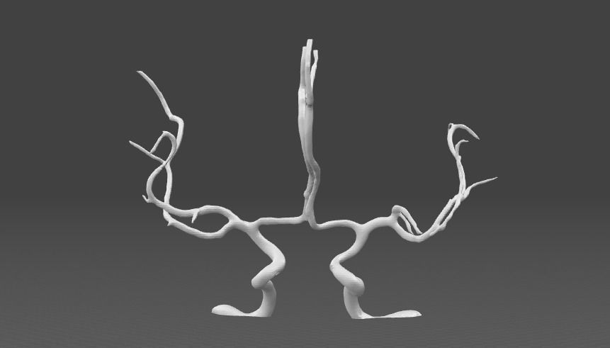 Cerebral arteries - male 3D model
