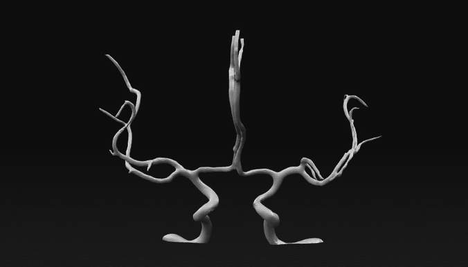 Cerebral arteries - male