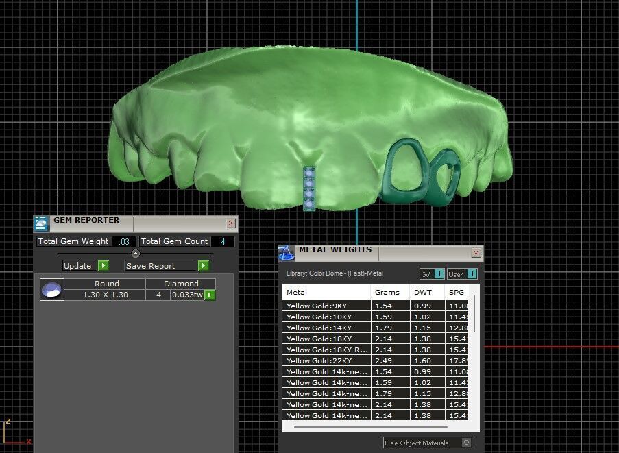 Grillz -gold -diamonds 3D print model_3