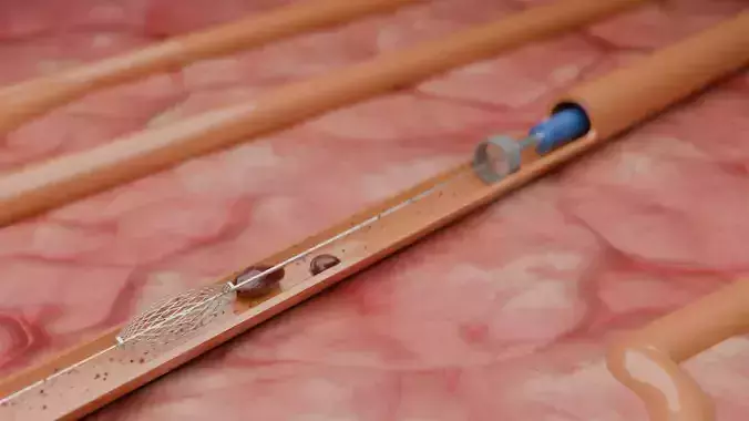 Blood Clot Formation Animation Medical 3D Blender Scene