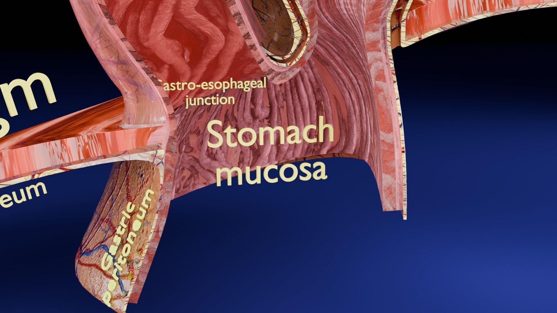 Hiatal hernia stomach sliding paraesophageal Low-poly 3D model_6