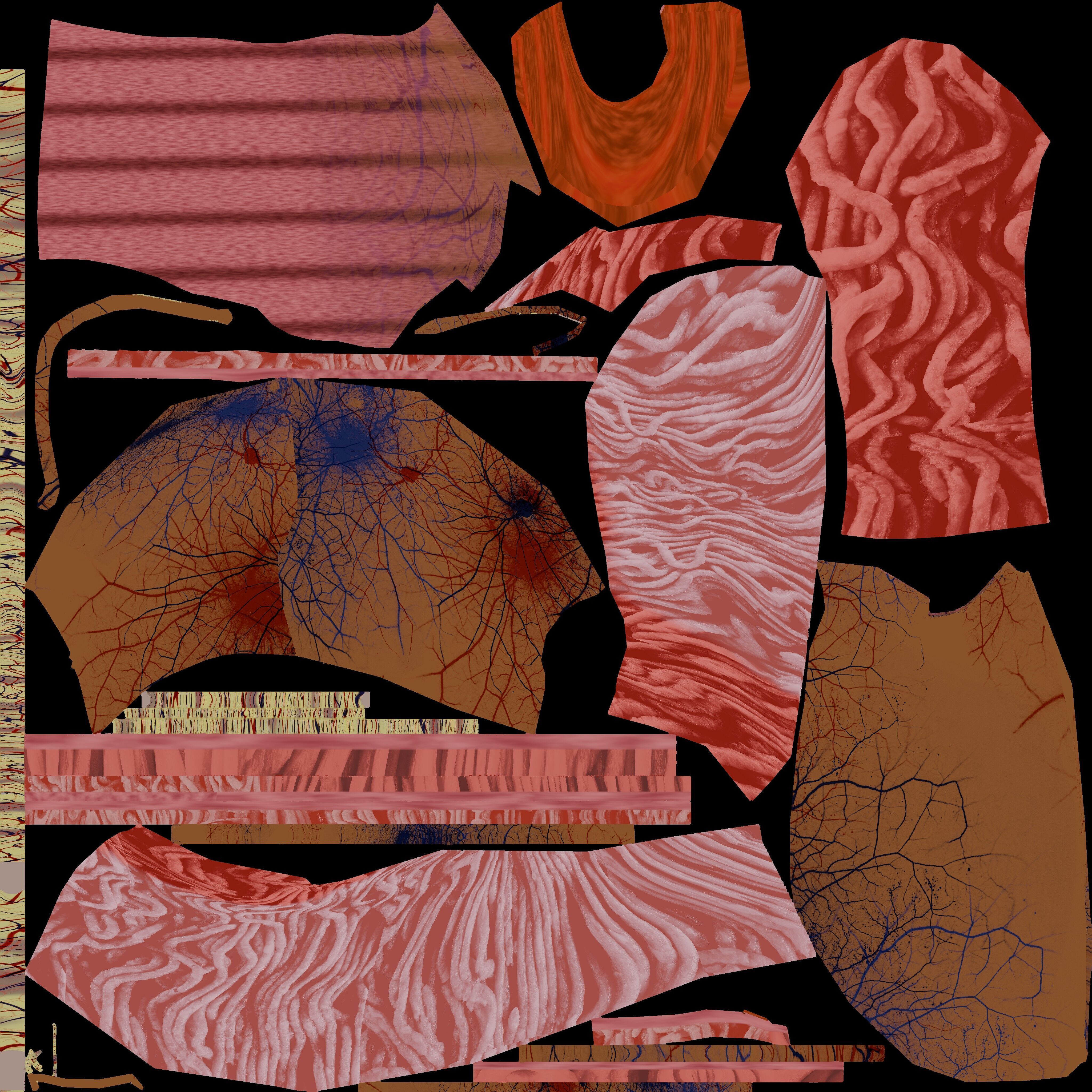 Hiatal hernia stomach sliding paraesophageal Low-poly 3D model_30