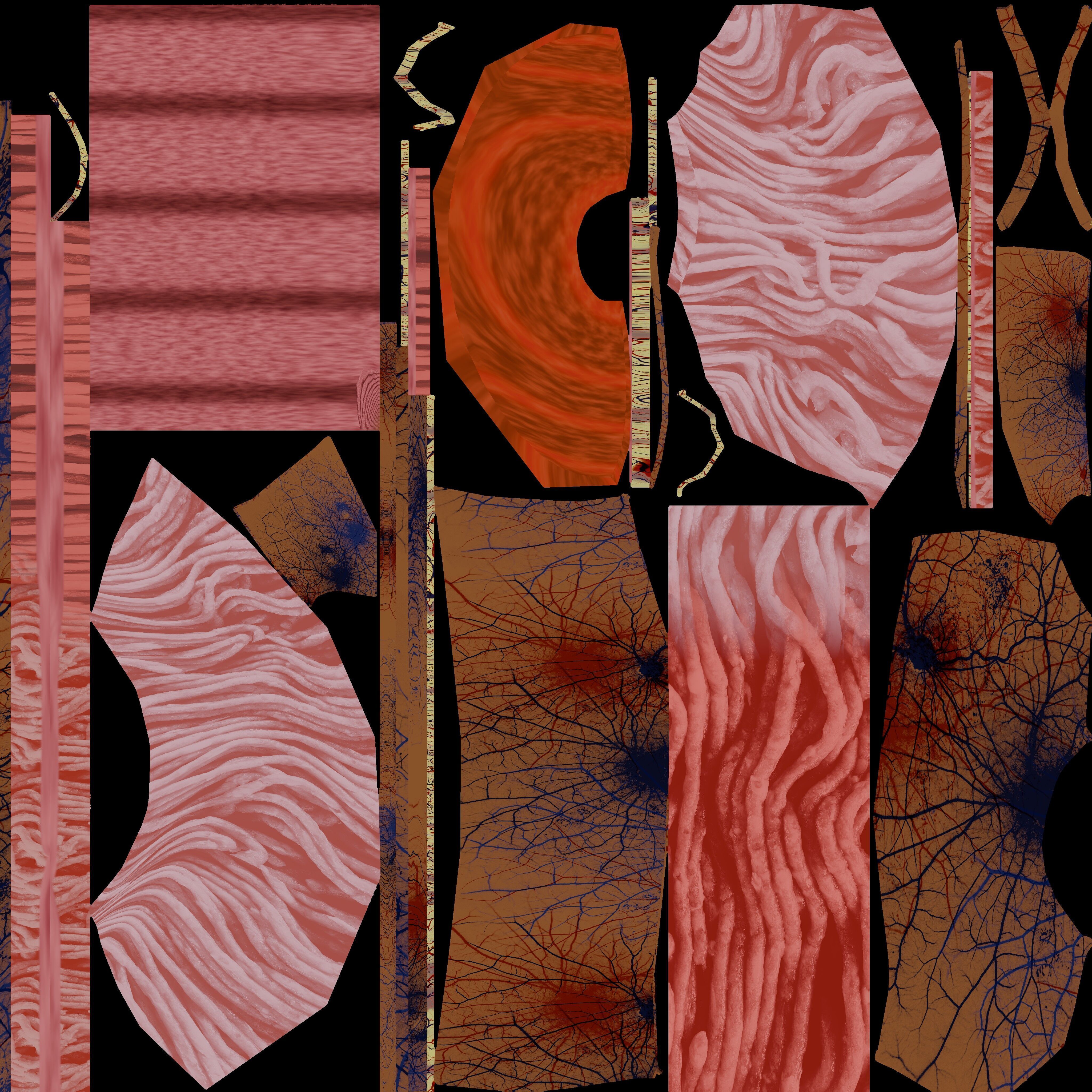 Hiatal hernia stomach sliding paraesophageal Low-poly 3D model_32