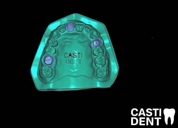 Tooth Preparation Models -Central-Premolar-Molar-CutbackTraining Low-poly 3D print model
