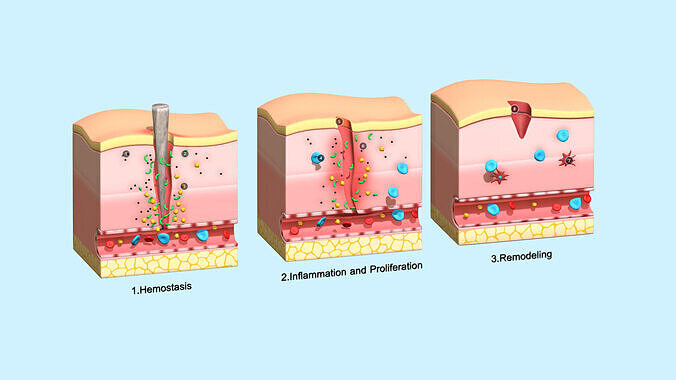 Skin Wound Healing Low-poly 3D model