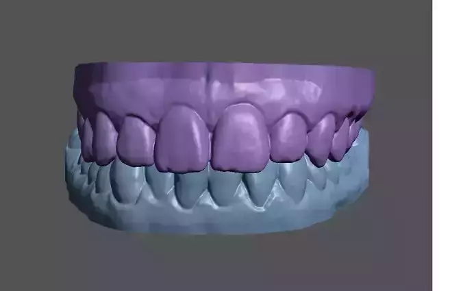 2 real teeth dental 3d models - 01