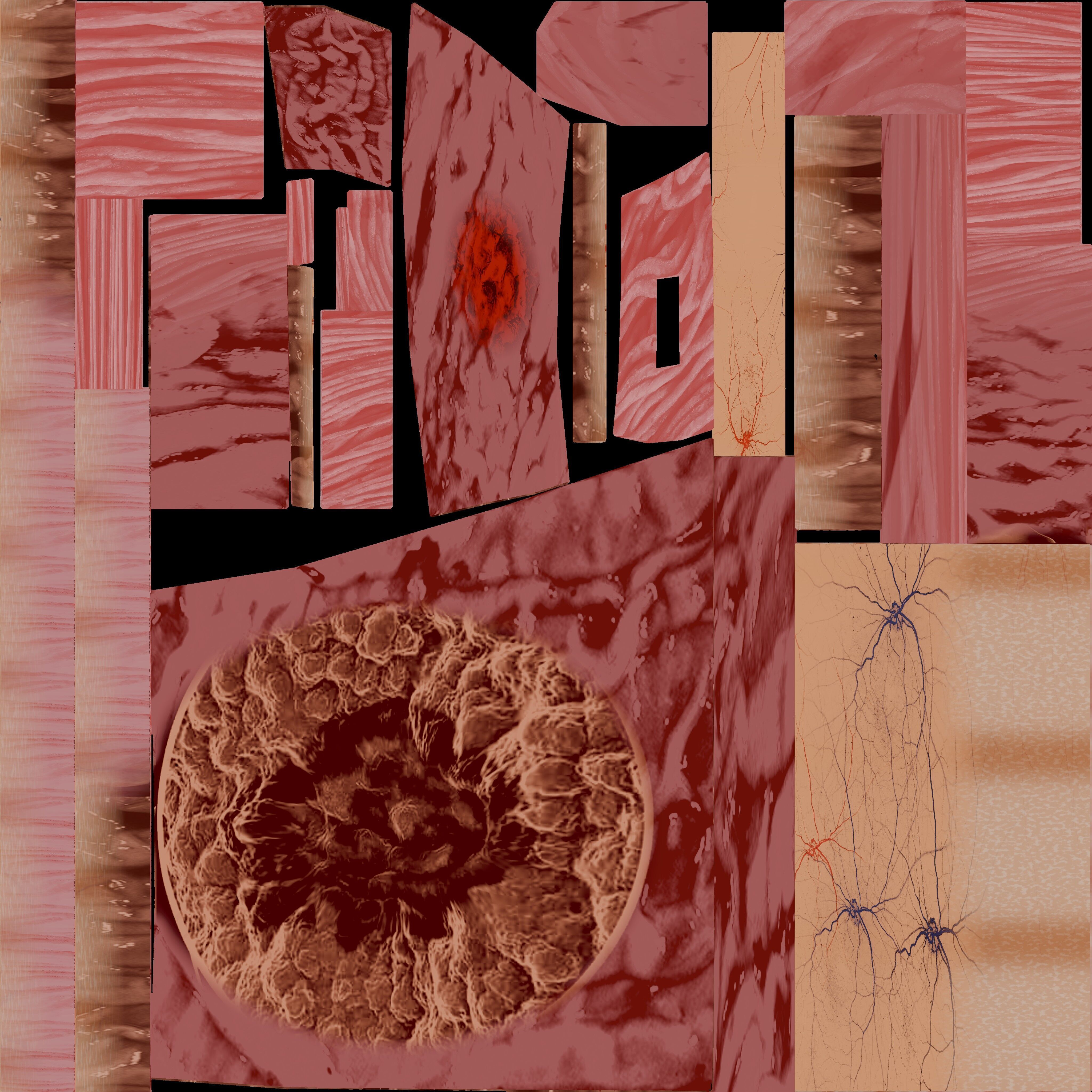 Gastric Ulcer Benign versus Malignant Low-poly 3D model_2