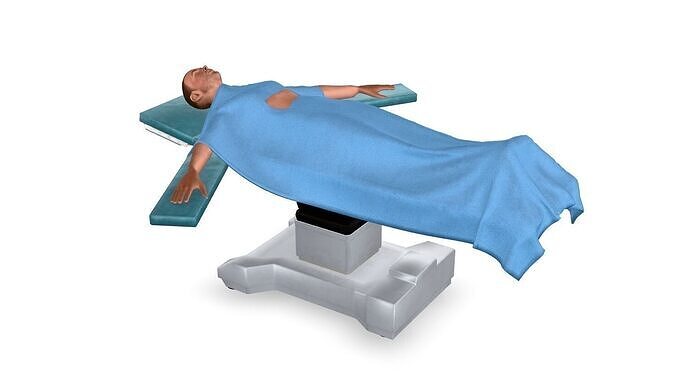Surgical bed with patient Low-poly 3D model