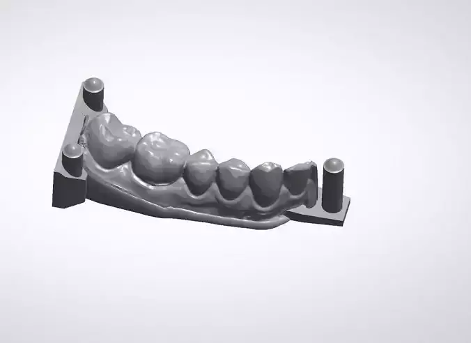 Teeth model dental implant Free 3D model