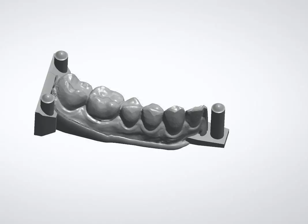 Teeth model dental implant Free 3D model_0