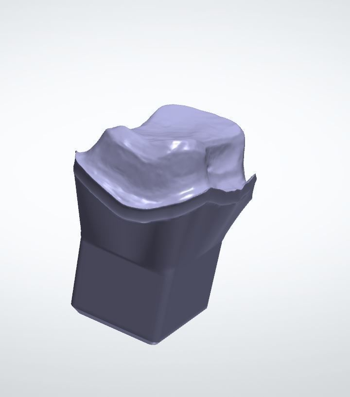 Teeth model dental implant Free 3D model_2
