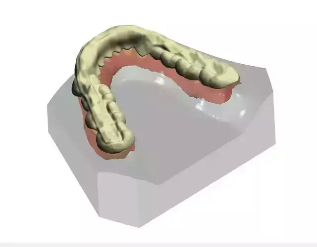 Splint Design  Free 3D print model
