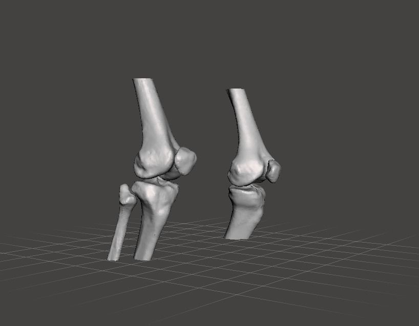 Knee joint - female 3D model_8