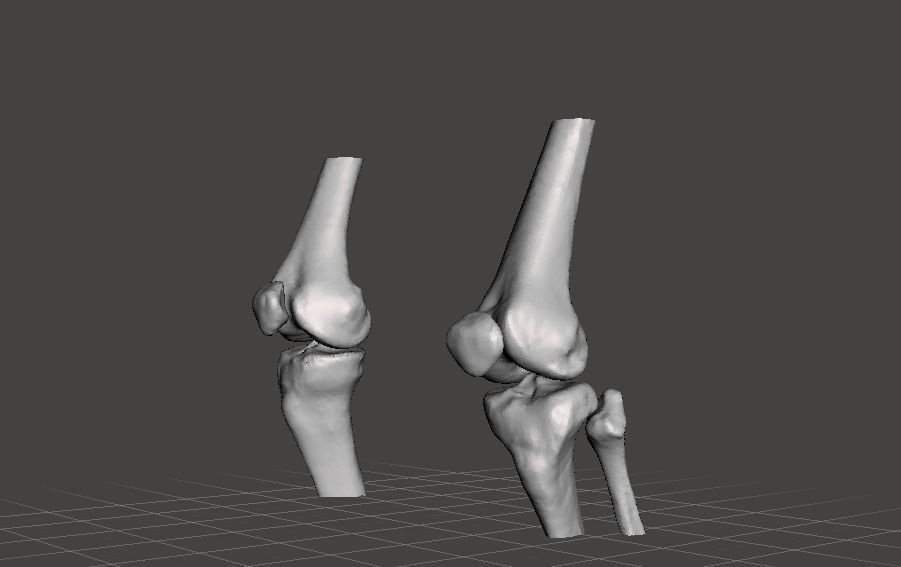 Knee joint - female 3D model_6
