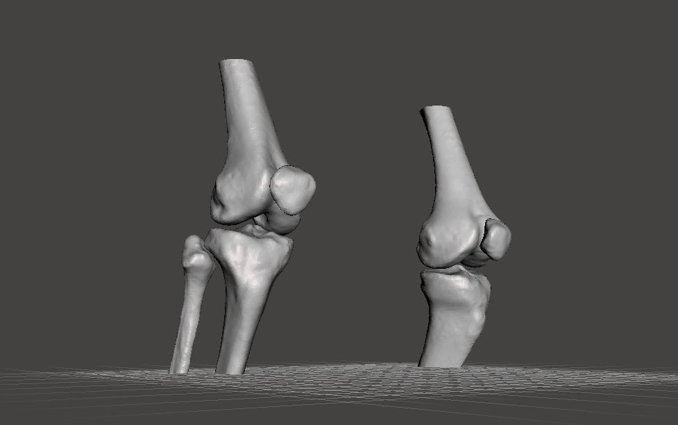 Knee joint - female 3D model_7