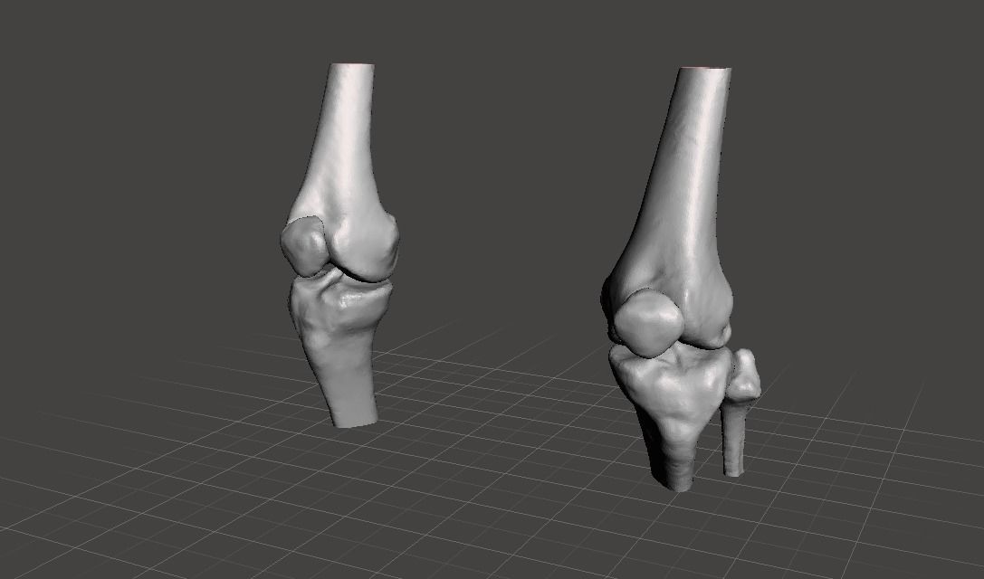 Knee joint - female 3D model_9