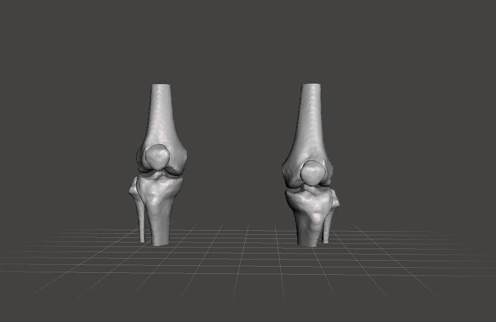 Knee joint - female 3D model_0